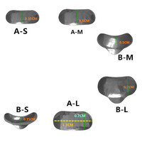 100 sztuk/zestaw Dental przekrój profilowane matryce Matrix Ring Delta kliny wypełnienie W 5